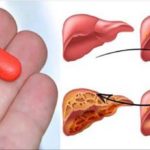 Drugs Warning As Doctors Say This Common Drug Destroys Your Liver