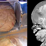 Prevent Your Children To Have Cancer At An Early Age By Not Giving Them That Food