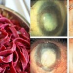 I Am 60 Years Old and This Plant Made Me Gained Back My Vision, Eliminate fats in My Liver and Clean My Colon