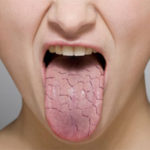 15 alarming diabetes signs you need to know
