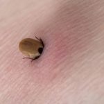 Here is The Best Natural Way to Remove Ticks and Why it Works